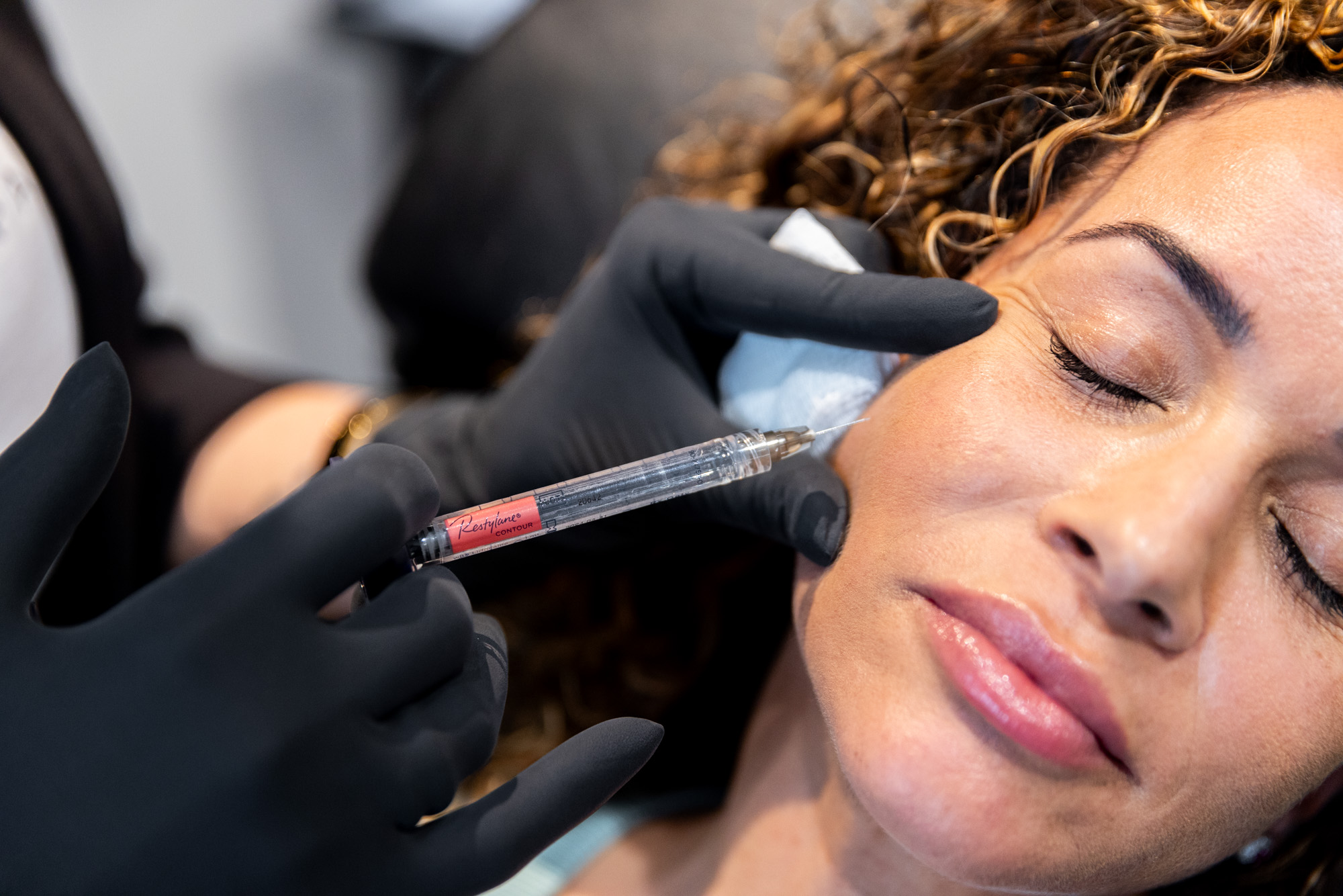 lip filler, restylane lip filler, restylane dermal filler, lips, lip flip, lip volume, lip structure, skin care, skinbetter, skin consult, free consultation