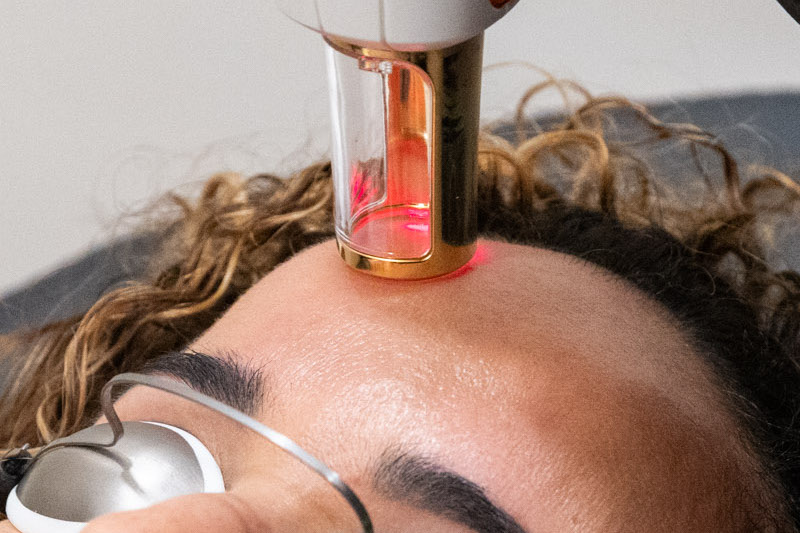 A woman is lying down with a ResurFX laser pressed against her skin for her treatment for laser skin resurfacing in Washingtonville, NY.